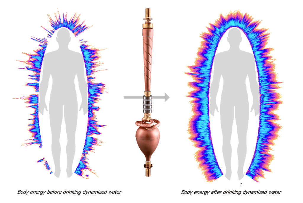 Body energy - Korotkov camera - Biodynamizer